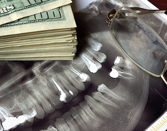 Money next to a dental x-ray