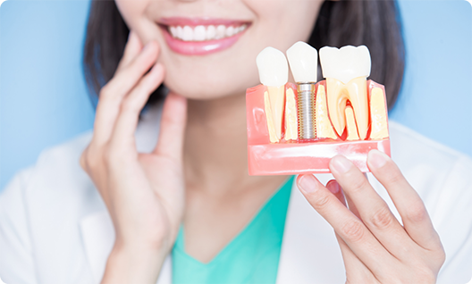 Female dentist holding model of dental implant