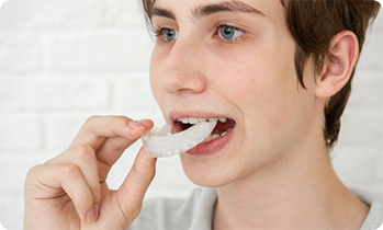 Man putting in a mouthguard