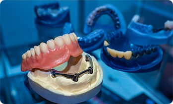 Dentures and dental implants on model of jaw