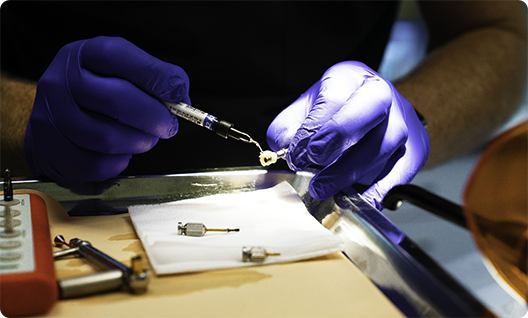 Close up of dentist working with tooth