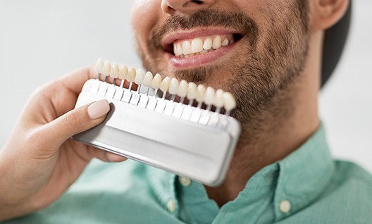 Comparing shade scale to patient's teeth