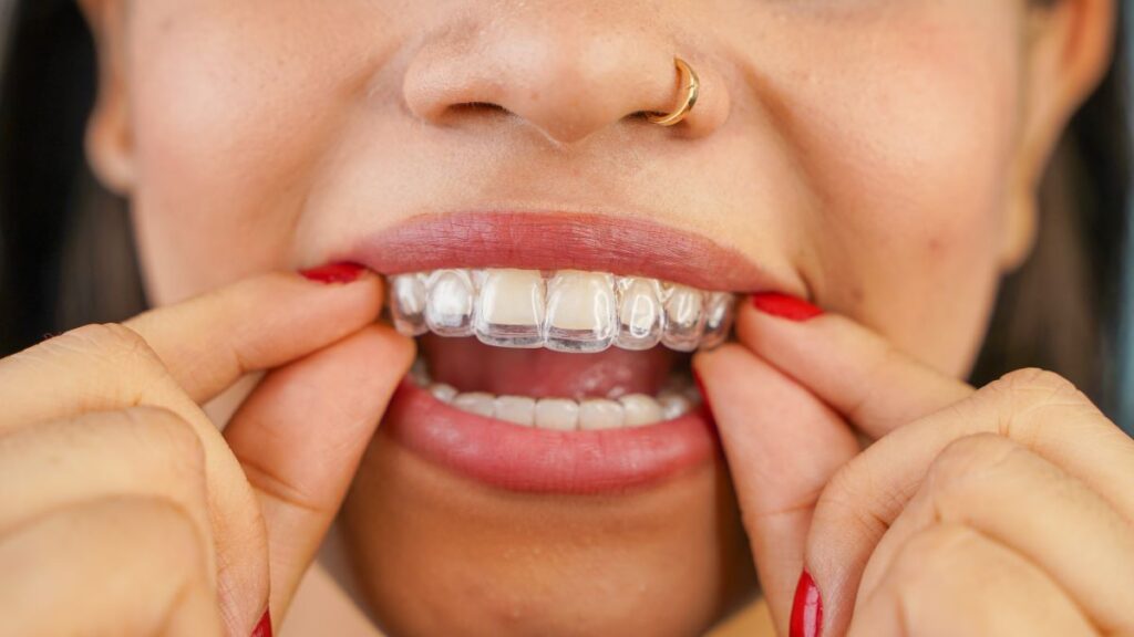 A woman putting on a CandidPro clear aligner.